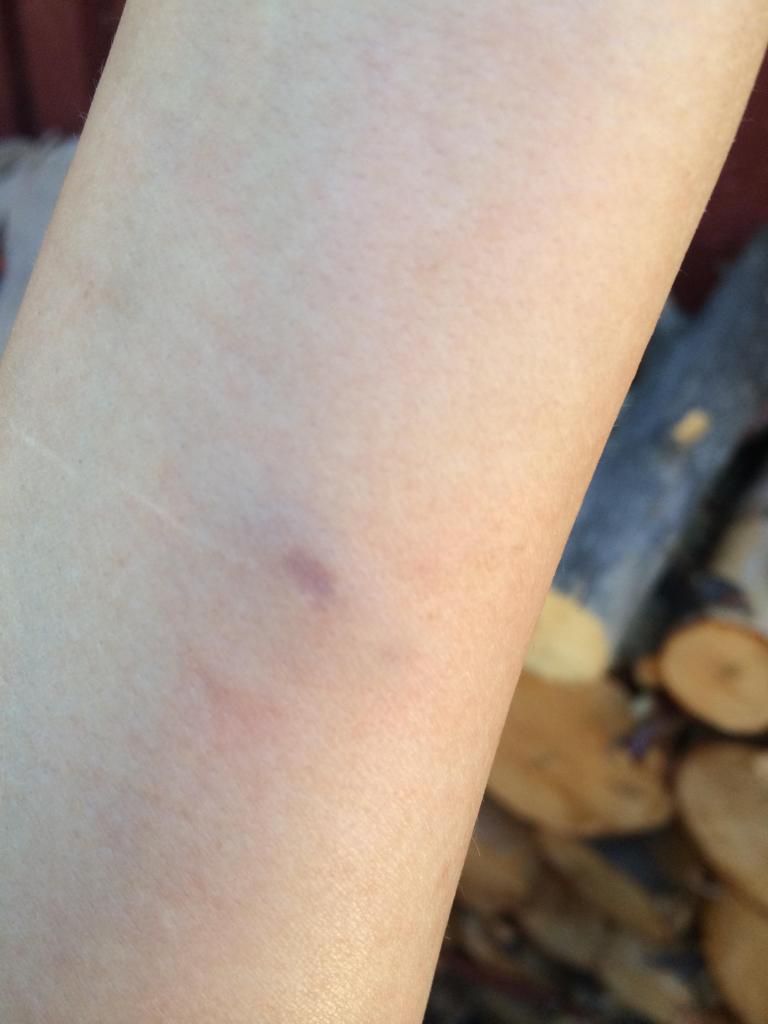 Banding horns photo tutorial Homesteading Forum